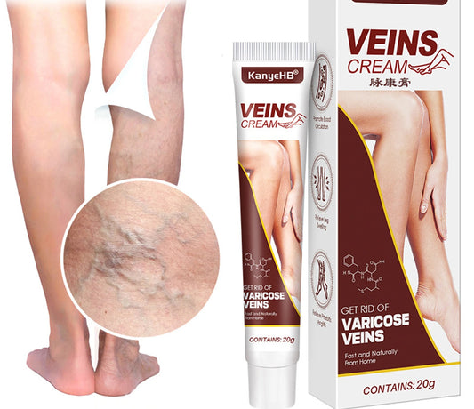 Kanye® Varicose Vein Relief Cream - Soothing Treatment for Spider Veins